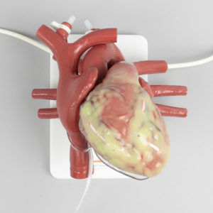 product photo of 1519 Cannulatable ECMO Beating Heart