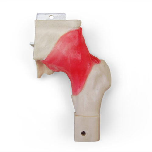 Hip Labrum Replacement Joint with Capsule (#6006)